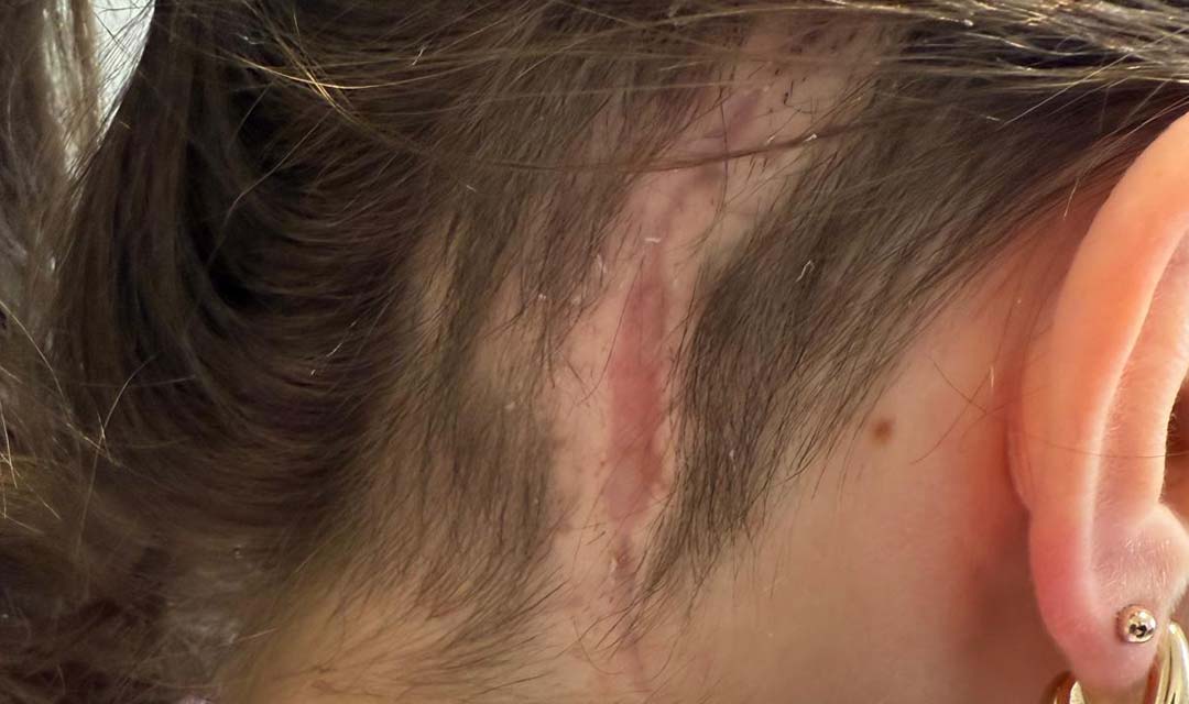Before image
