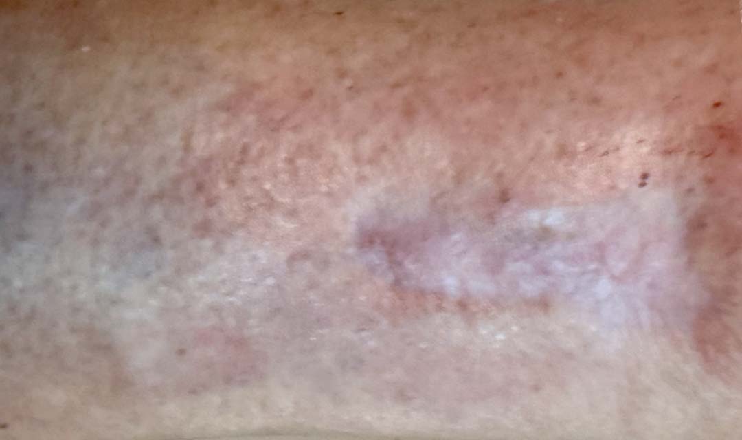 After image